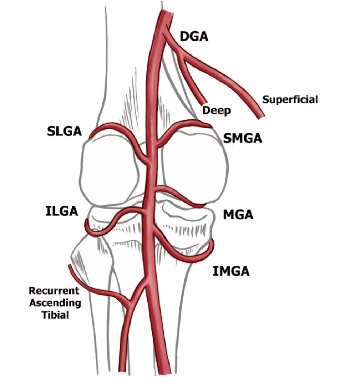 Schematic of the genicular arteries around the knee, labelled: descending genicular
       (DGA) with its deep and superficial branches, superior lateral and superior medial genicular
       (SLGA, SMGA), inferior lateral and inferior medial genicular (ILGA, IMGA), middle genicular
       (MGA), and the recurrent ascending tibial artery