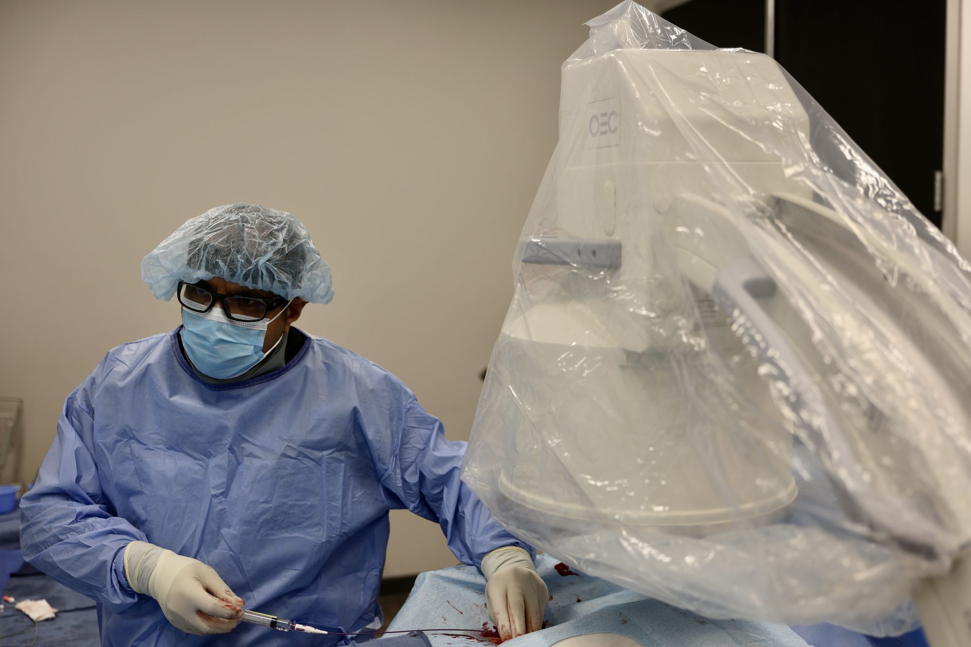 Dr. Samy Al-Bayati performing a plantar fascia embolization