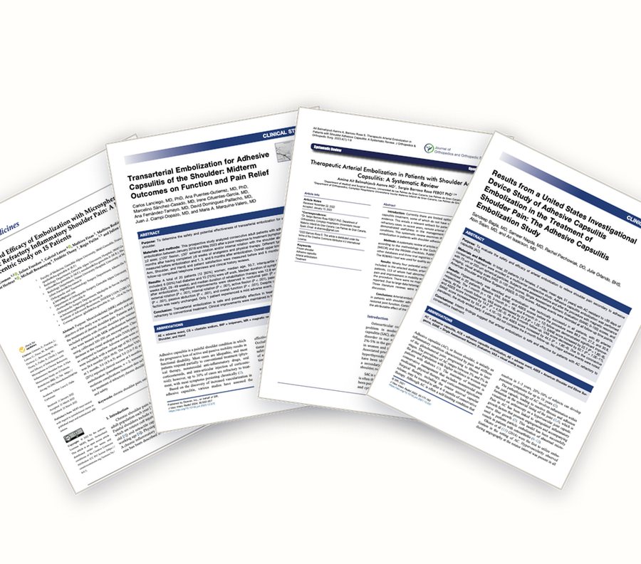 A fanned stack of real published journal articles on shoulder artery embolization