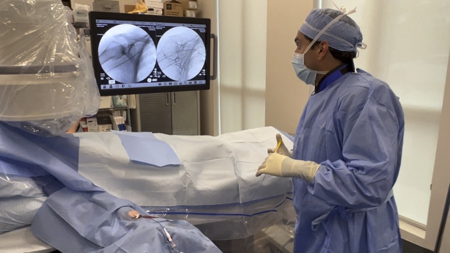 A patient undergoing shoulder artery embolization in the ARV Centers procedure suite