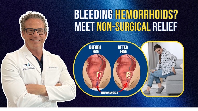Video: the ARVC team explains how hemorrhoid artery embolization works