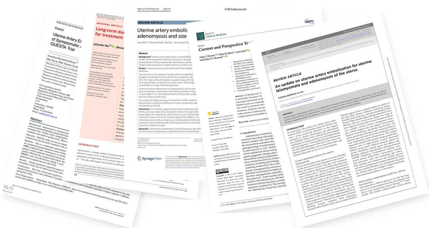 A fanned stack of published journal articles on uterine artery embolization for adenomyosis