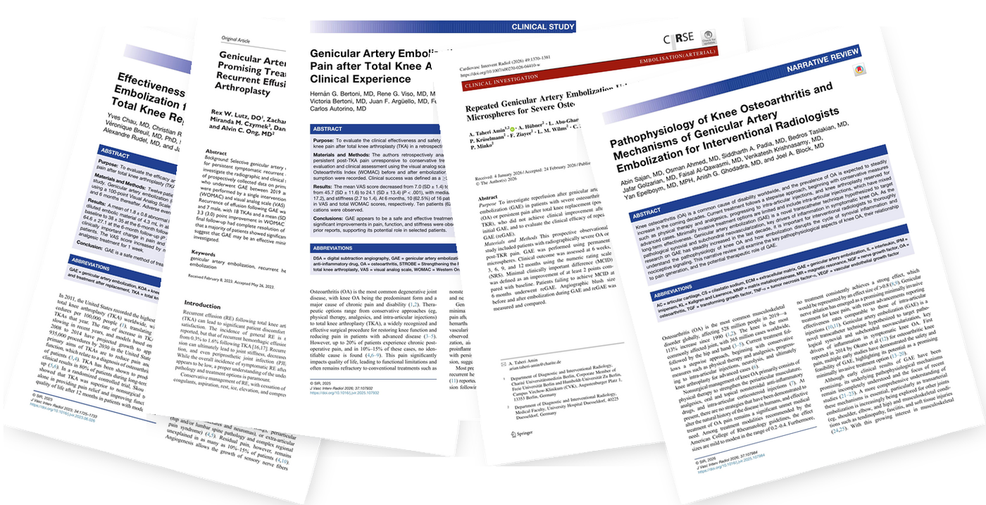 A fanned stack of published journal articles on genicular artery embolization for pain and swelling after total knee replacement