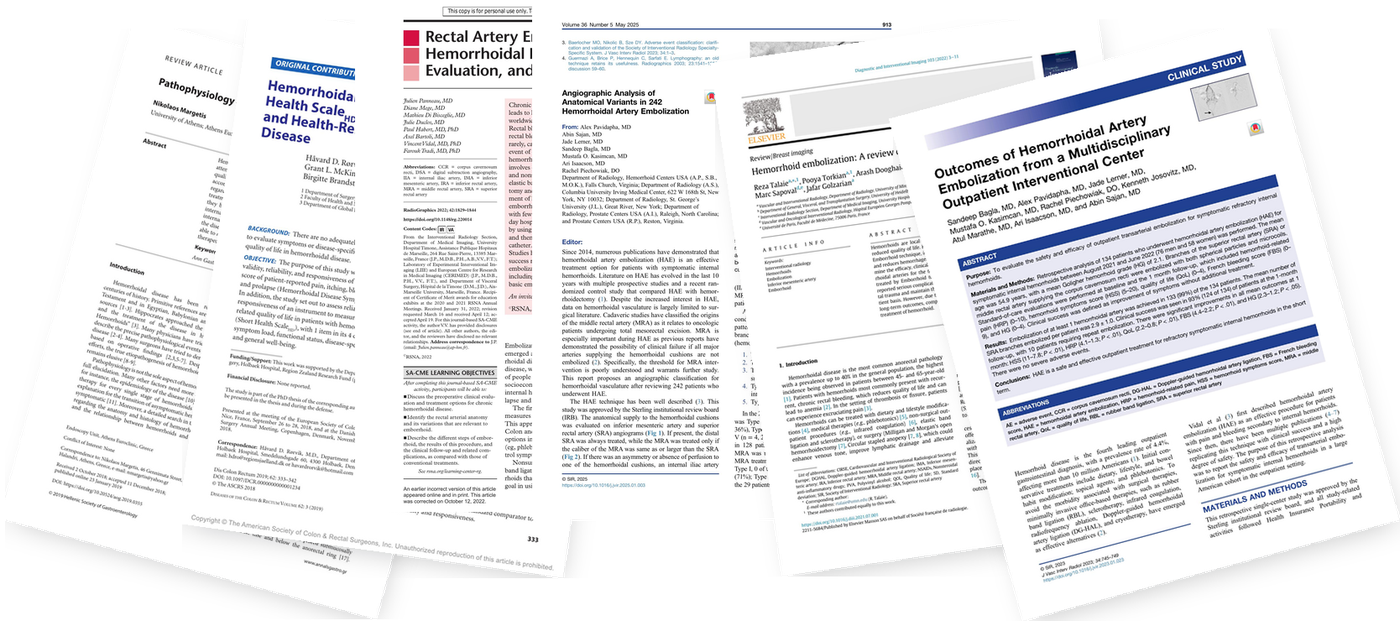 A fanned stack of published journal papers on hemorrhoid embolization