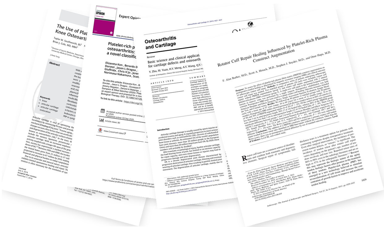 A fanned stack of published journal articles on platelet-rich plasma for osteoarthritis and tendon repair