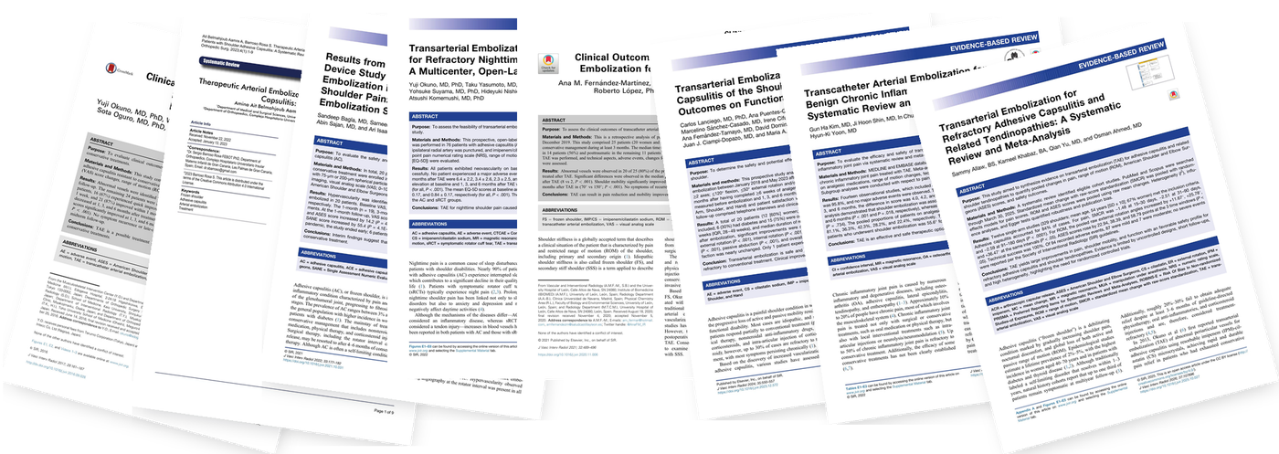 A fanned stack of published journal articles on transarterial shoulder embolization